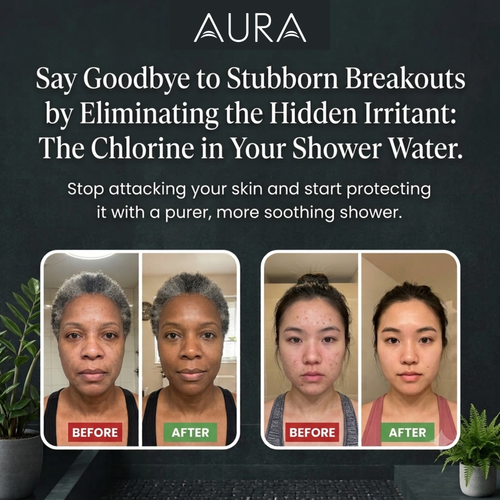 Filtered Showerhead + 1 year Filter Pack